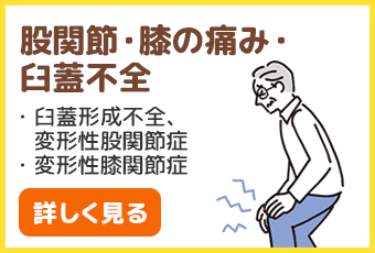 股関節、膝の痛み、臼蓋不全、臼蓋形成不全、変形性股関節症、変形性膝関節症